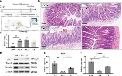 Mechanism of electro-acupuncture in alleviating intestinal injury in septic mice via polyamine-related M2-macrophage polarization
